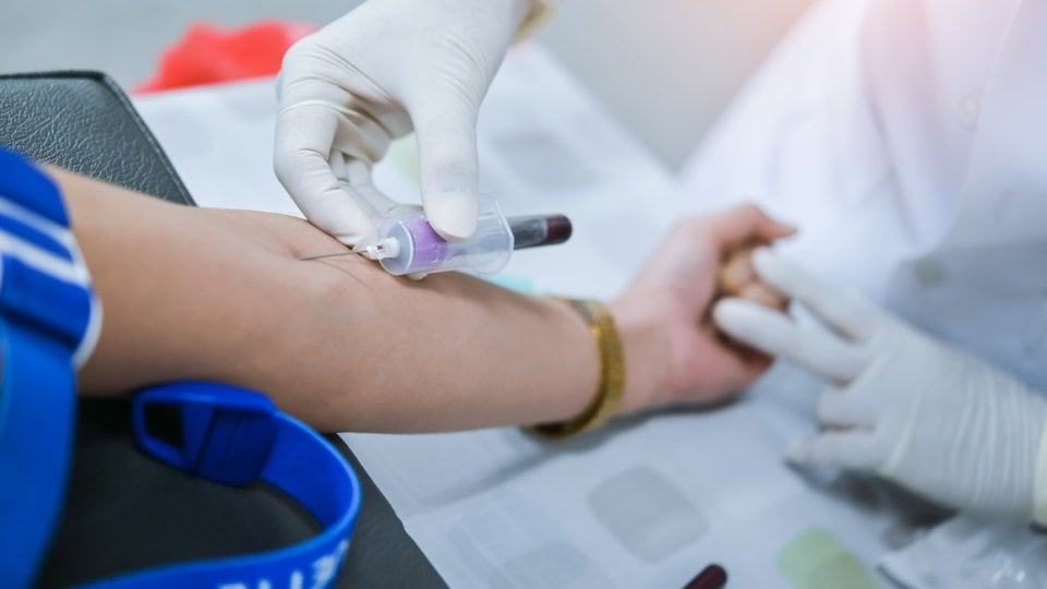 lipoprotein(a), poznat i kao Lp(a), može značajno povećati rizik od moždanog udara čak i kod osoba koje već primaju standardnu terapiju za kolesterol