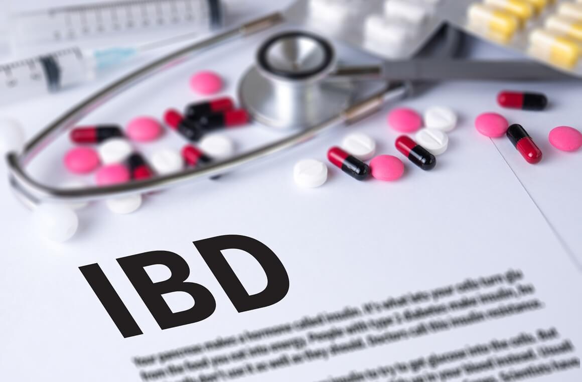 za IBD još uvijek ne postoji lijek