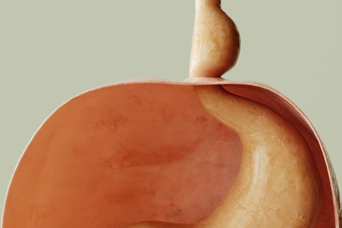 Hijatalna hernija