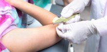 Kontracepcijski implantat