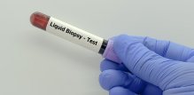 Tekuća biopsija