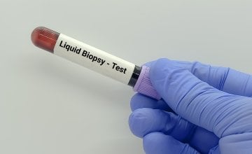 Tekuća biopsija