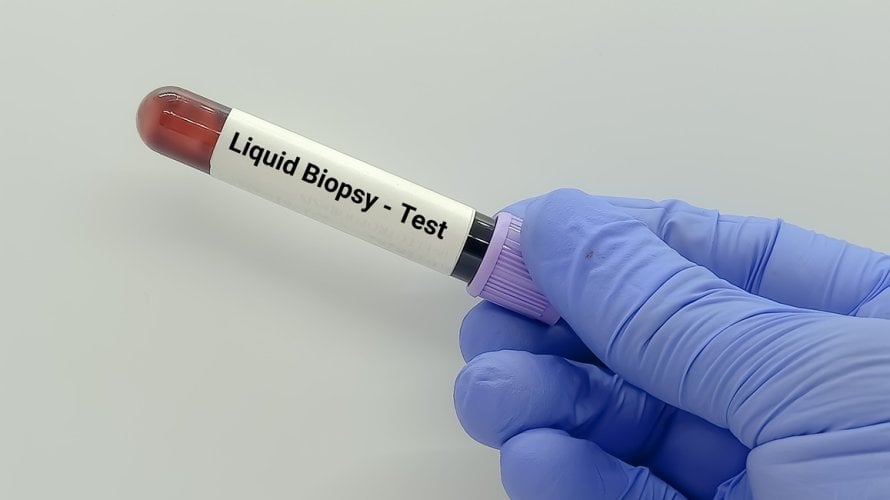 Tekuća biopsija