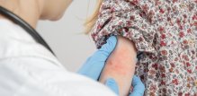 Atopijski dermatitis sam po sebi nije kontraindikacija za cijepljenje
