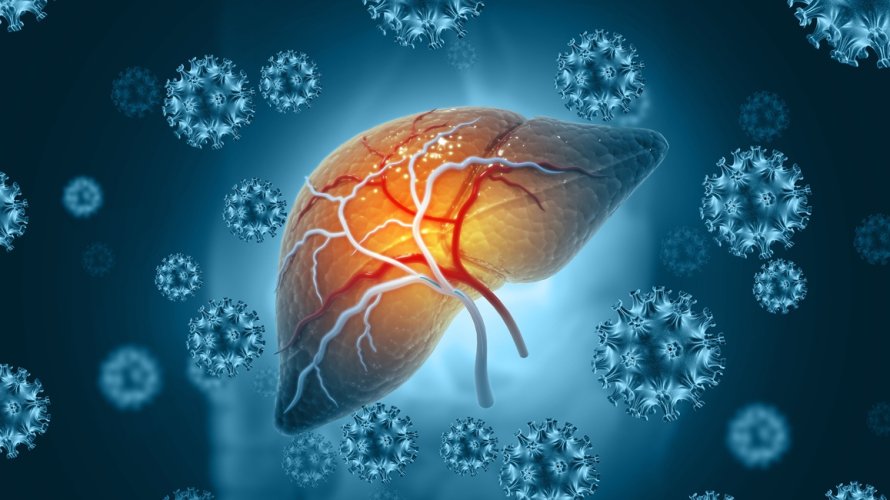 Hepatitis je vodeći uzrok raka jetre u svijetu