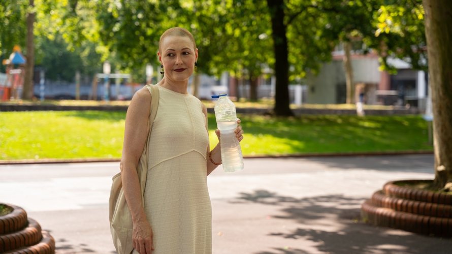 Ljetne vrućine mogu biti posebno izazovne za osobe koje imaju alopeciju